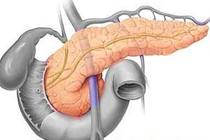 Причины хронического панкреатита