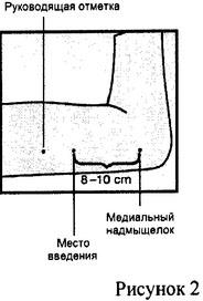 ИМПЛАНОН НКСТ